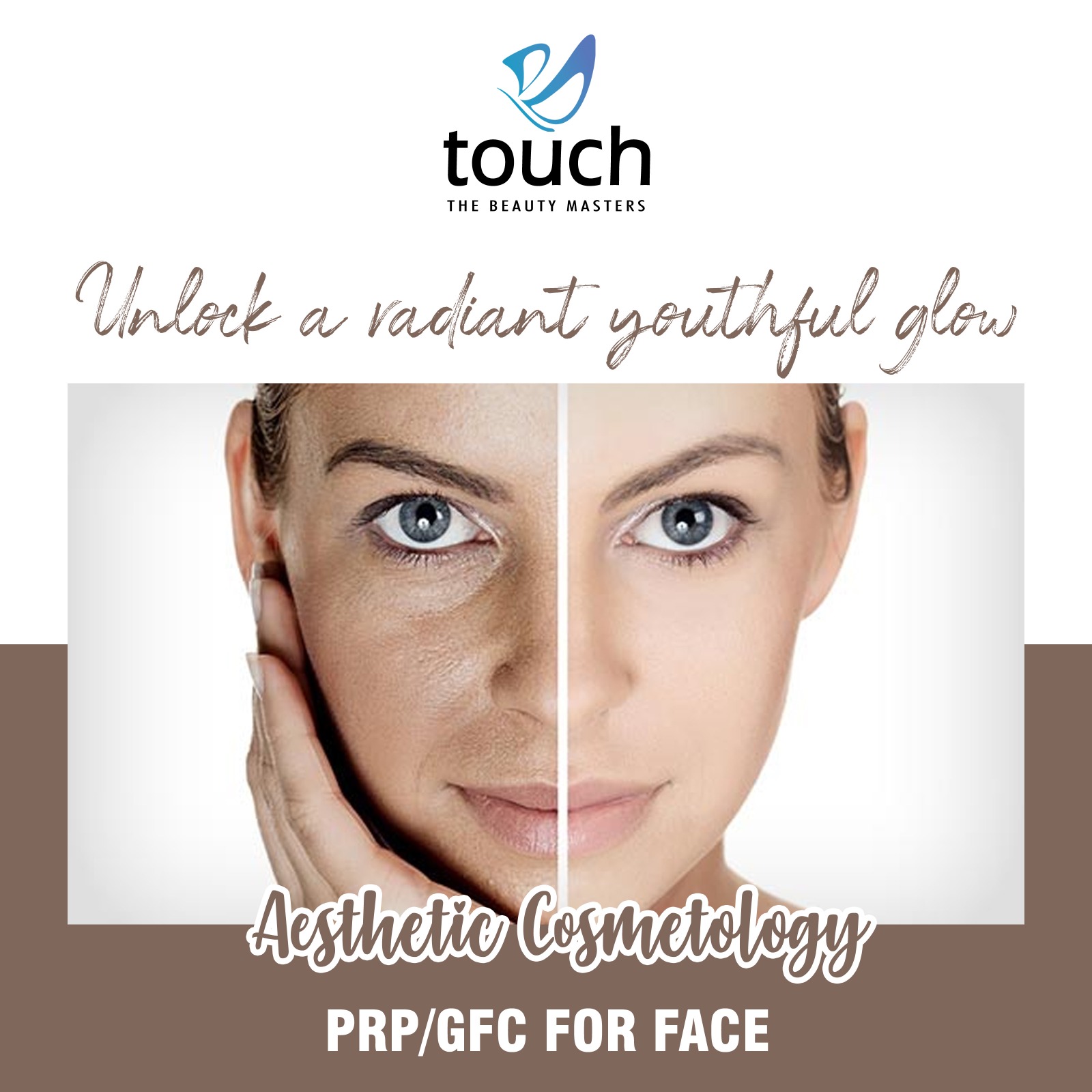 PRP-GFC for Facial Rejuvenation